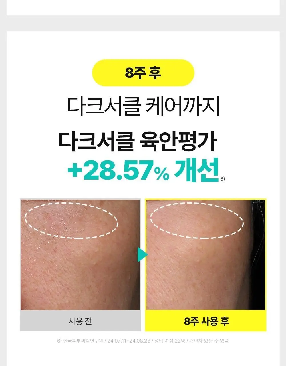 [아이백패치] 더마펌 비타액티브 마이크로크리스탈 패치플러스 3종 택1 상세페이지 26